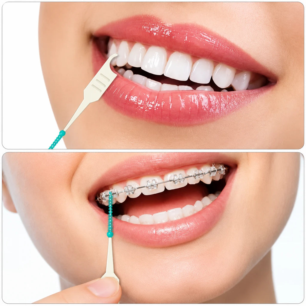 Dental Interdental Brushes – Teeth Cleaning Brushes | 8 Pcs